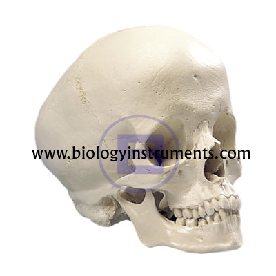 Hydrocephalic Skull
