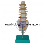 Lumbar Vertebrae with Sacrum & Coccyx and Herniated Disc